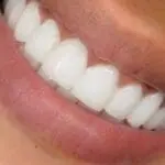 Oral Care