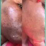 By Skin Concern