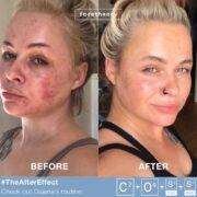 Face theory BHA Exfoliating Serum S3 Prowith 3% Carnitine and 2% Salicylic Acid.