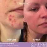 Face theory Supergel Oil-free Moisturiser M3 for Oily and Acne-Prone Skin - Image 2