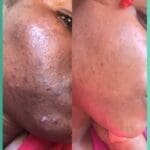 By Skin Concern